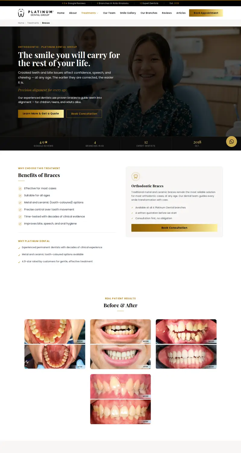 Platinum Dental Group website: Braces page